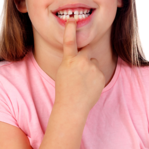 cracked tooth Fallsgrove Center for Dentistry